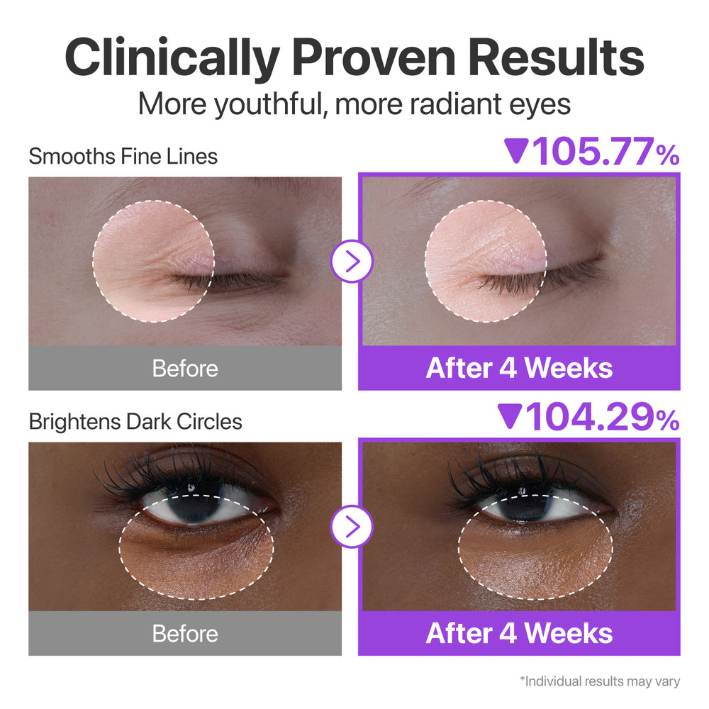 Numbuzin No.9 NAD+ Retinol Volumetox Eye Cream
NAD+ and Retinol